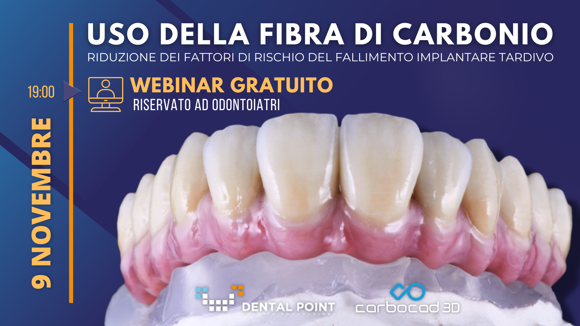 Webinar fibra di carbonio