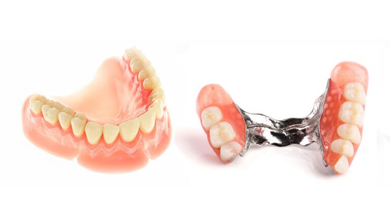 protesi dentale fissa protesi dentale mobile